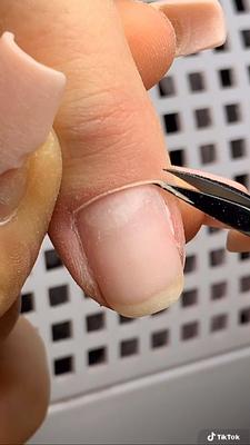 Listing thumbnail